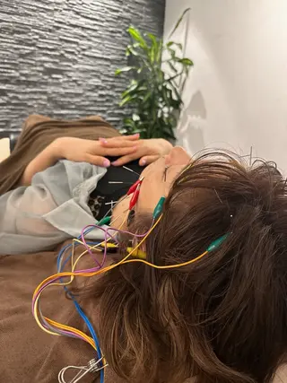 美容鍼灸整体サロンBeauJu所属・小顔矯/美容鍼/鍼灸 BeauJuのその他イメージ