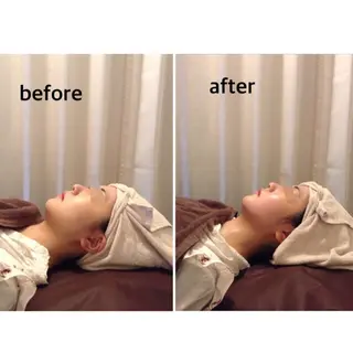 小尻・太もも痩せる エステルナボーテのエステ・リラクイメージ