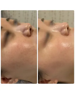 Astorie 相模大野エステのその他イメージ