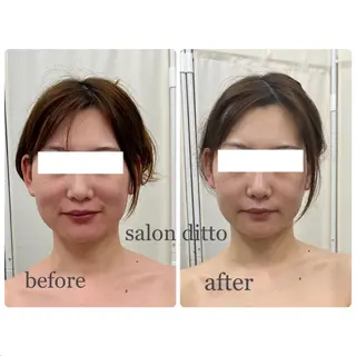 salon ditto所属・mio (小顔・ヘッドスパ)のエステ・リラクイメージ