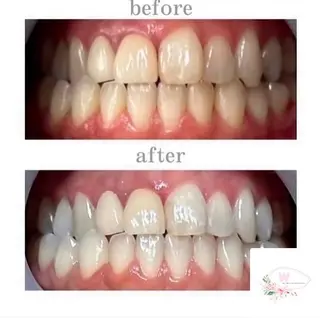 ホワイトニングショップ本厚木所属・ホワイトニング ショップ本厚木のその他イメージ