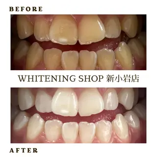 メンズ ホワイトニング ショップ新小岩店のその他イメージ