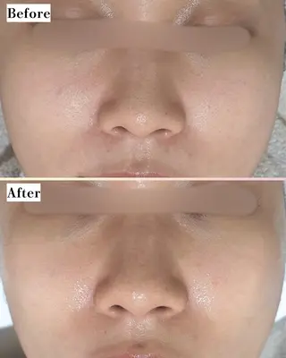 s o i n a🤍🪽ララピール/毛穴/小顔/水光肌所属・s o i n a 神楽坂のエステ・リラクイメージ