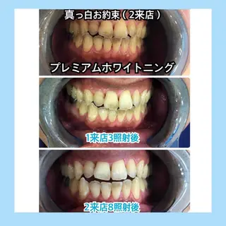 ホワイトニング|韓国式3D毛穴洗浄 lonhana ロンハナ所属・韓国式3D毛穴洗浄 lonhanaのその他イメージ