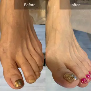 ネイル 木村 千晴のネイルデザイン