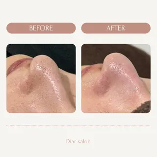 Diar salonのエステ・リラクイメージ