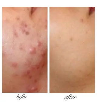 自爪育成ネイルサロン ココリュバンのネイルデザイン