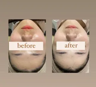 crescent所属・【韓国肌管理・脱毛】 クレセントのエステ・リラクイメージ