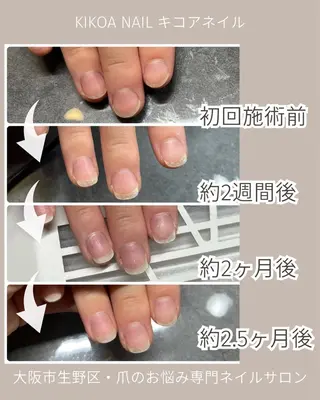 ネイル KIKOA NAIL キコアネイルのネイルデザイン