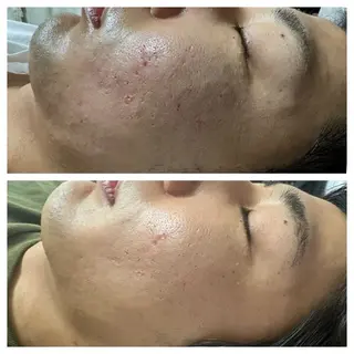 Leafy所属・内川 みうのエステ・リラクイメージ