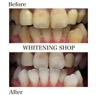 ホワイトニングショップ伊丹店所属・ホワイトニング ショップ伊丹店のその他イメージ