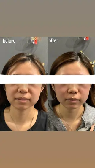 エステサロンino.colore'所属・小顔サロン ino.coloreのエステ・リラクイメージ