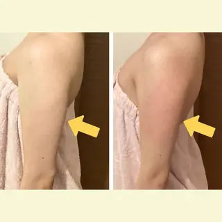 レモンボトル 痩身calicoのエステ・リラクイメージ