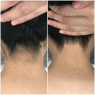 高速脱毛エステ リアンのエステ・リラクイメージ