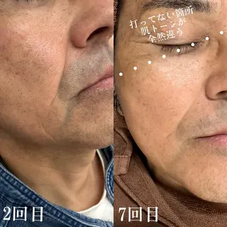 メンズ meravi所属・MERAVI 🫧🌿のマツエク・マツパデザイン