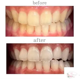 ホワイトニングショップ本厚木所属・ホワイトニング ショップ本厚木のその他イメージ