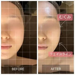 MIRAI小顔所属・MIRAI小顔 名古屋店のエステ・リラクイメージ