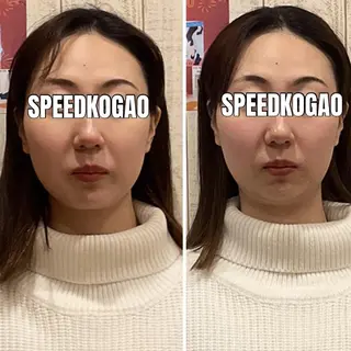 小顔矯正Speed KOGAO渋谷本店のエステ・リラクイメージ