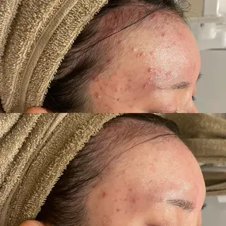 Re:Belle所属・Re:Belle 久留米 : 中島のエステ・リラクイメージ