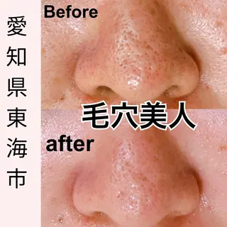 トータルビューティー サロンLilyのエステ・リラクイメージ