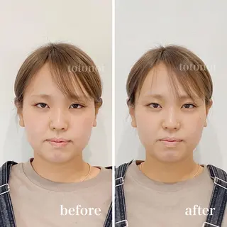 はり灸サロン　totonoi所属・筋膜リリース 小顔美容鍼のエステ・リラクイメージ