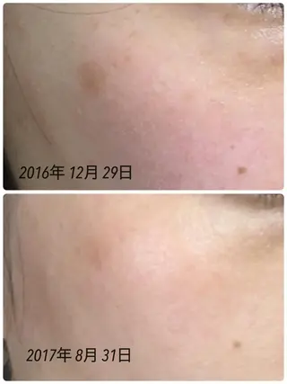 メナードフェイシャルサロン西区天塚所属・平岩 仁美のエステ・リラクイメージ