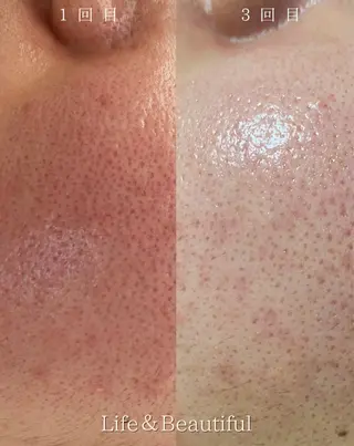 Life＆ Beautifulのエステ・リラクイメージ