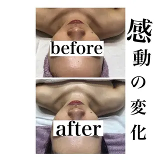 メンズ beauty salonnのエステ・リラクイメージ