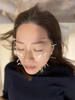 むくみたるみ専門☆ 美容鍼・小顔矯正のエステ・リラクイメージ