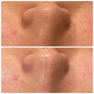 yellow.所属・yellow💛【 脱毛&フェイシャル】のエステ・リラクイメージ