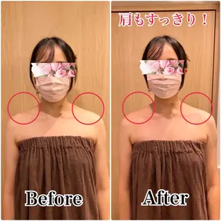 痩身×フェイシャル ブライダル|Linoのエステ・リラクイメージ