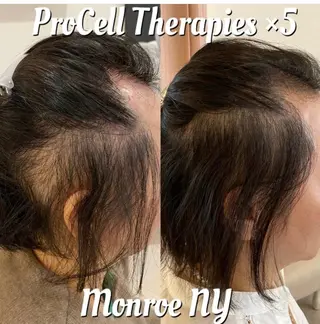 Blooming所属・LOUISE. ／肌質・頭皮のエステ・リラクイメージ