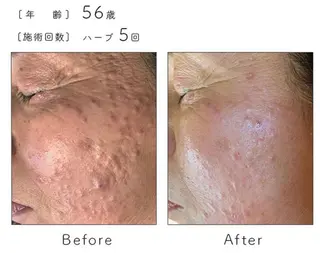 ハーブピーリング専門 BIOPLUS+川崎のエステ・リラクイメージ