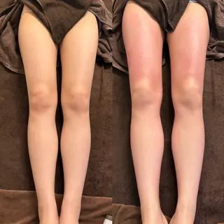 セルフエステエンリケ明石大久保店所属・夕希リンパ&痩身& 脱毛&毛穴ケアのエステ・リラクイメージ