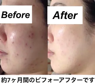 都度払い肌質改善 &脱毛Blancheのエステ・リラクイメージ