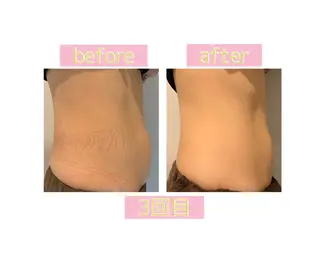 癒し腸もみサロン シャユーム　ゆきなのエステ・リラクイメージ