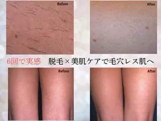 VIKI BEAUTY  クレイハーブピーリング・美肌脱毛専門店所属・VIKI BEAUTYのエステ・リラクイメージ