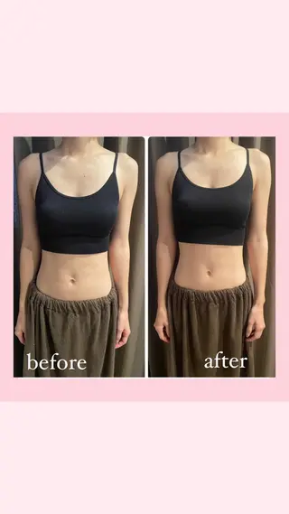 Monreve所属・美人スイッチdiet スーパージェクションのその他イメージ