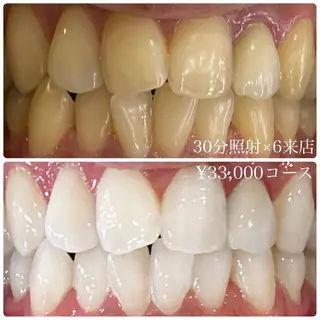 メンズ ホワイトニングルーム　川崎店所属・ホワイトニング ルーム　川崎店のその他イメージ