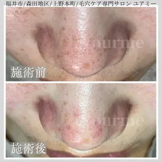 毛穴ケア専門サロン Yourmeユアミーのエステ・リラクイメージ