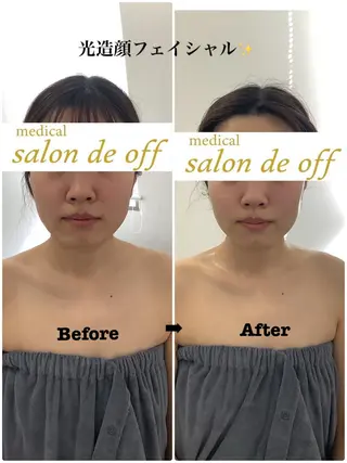 🩵Tatsumi Kana🩵のエステ・リラクイメージ