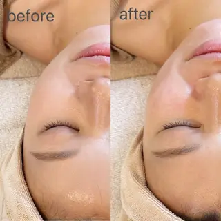 MiEL total beauty salon所属・Rie ×MiELのエステ・リラクイメージ