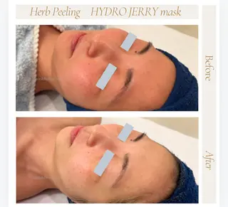 艶肌ワックス ALLY.のエステ・リラクイメージ