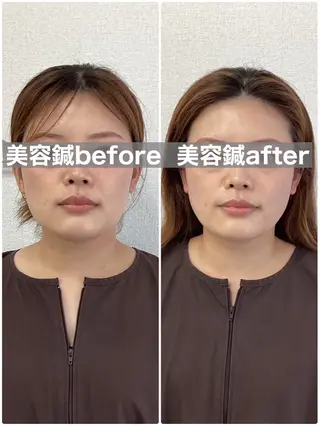 hari salon de off 美容鍼灸×小顔整体【ハリサロンドオフ】所属・美容鍼×小顔整体🤍 ishibashiのエステ・リラクイメージ