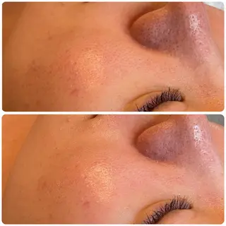 立体小顔×艶肌×美ボ ディ似合わせ施術 岡のエステ・リラクイメージ