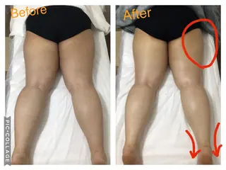 子宮矯正/腸揉み/ シュガーリング脱毛のエステ・リラクイメージ