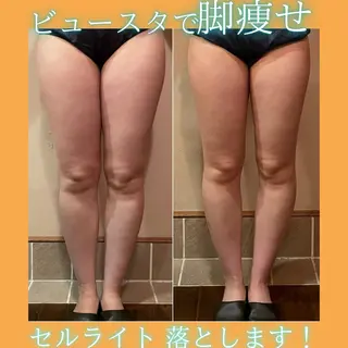 🫧ビュースタ 伊藤🫧のエステ・リラクイメージ