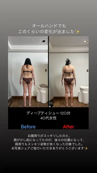 salon jiuu 巻き肩・肩こり・猫背のエステ・リラクイメージ