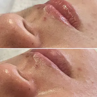 Lei beauty salon所属・松ヤニワックス専門/ 梅田/Leiのエステ・リラクイメージ