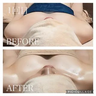 肩こり・腰痛改善専門 1万人以上施術の碧人のエステ・リラクイメージ